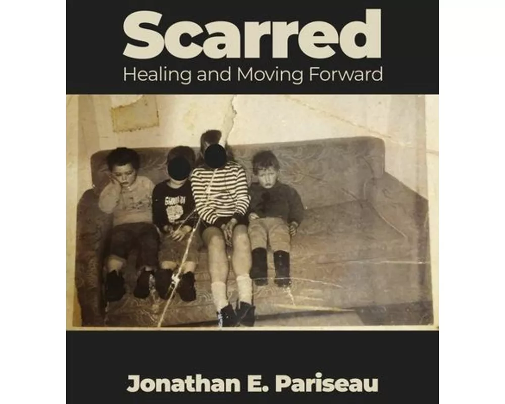 Scarred: Healing and Moving Forward