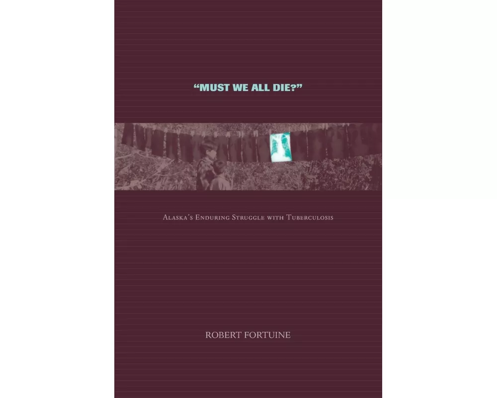 Must We All Die?