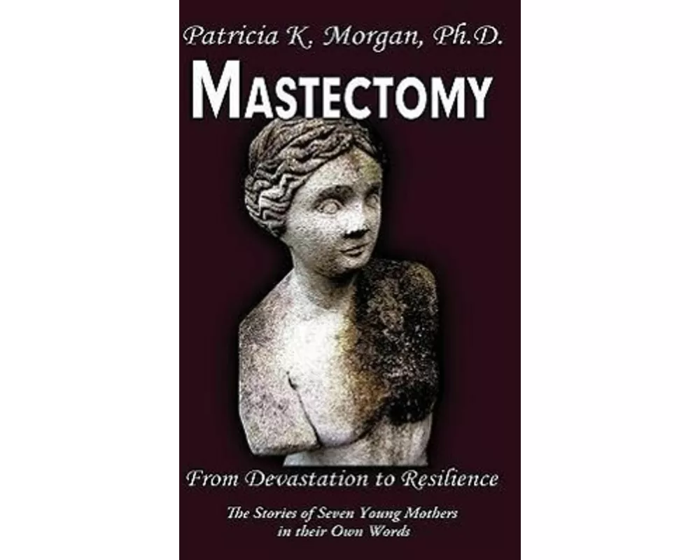 Mastectomy