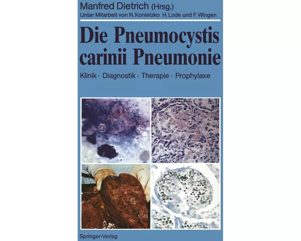 Die Pneumocystis carinii Pneumonie