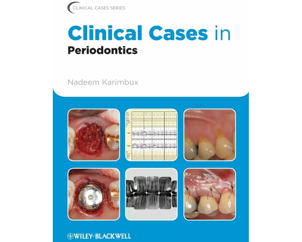 Clinical Cases in Periodontics
