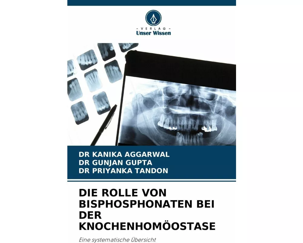 Die Rolle Von Bisphosphonaten Bei Der KnochenhomÖostase