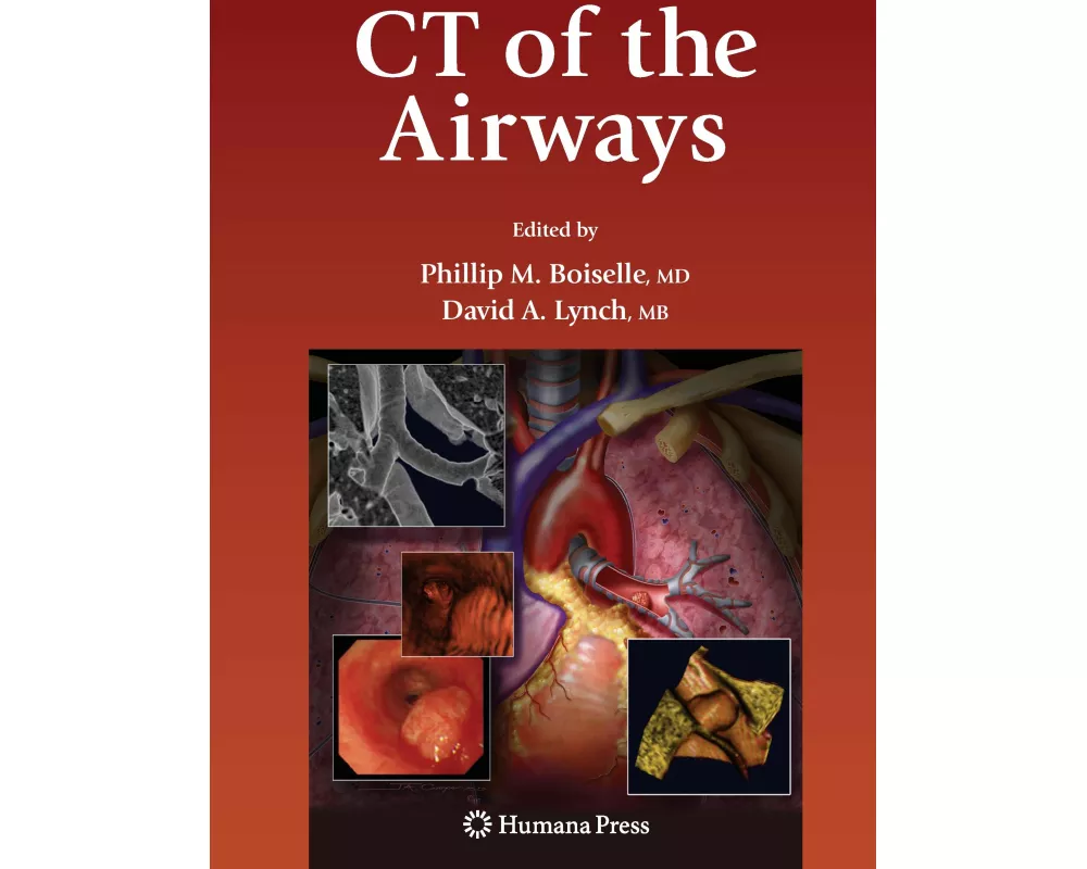 CT of the Airways