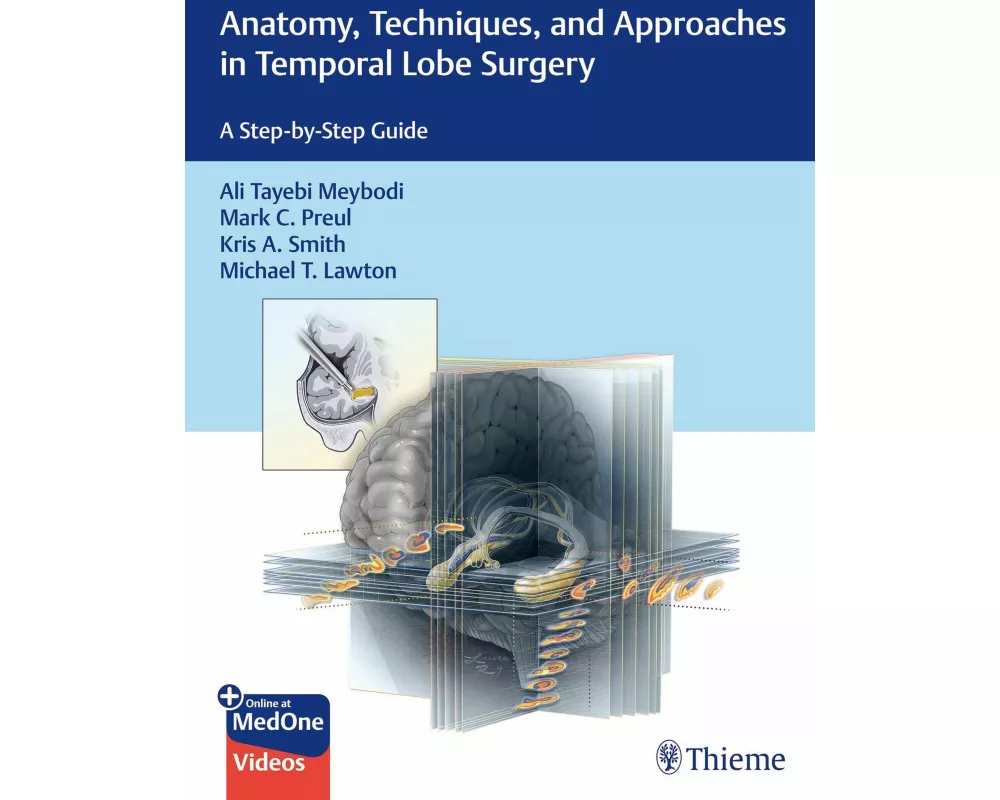 Anatomy, Techniques, and Approaches in Temporal Lobe Surgery