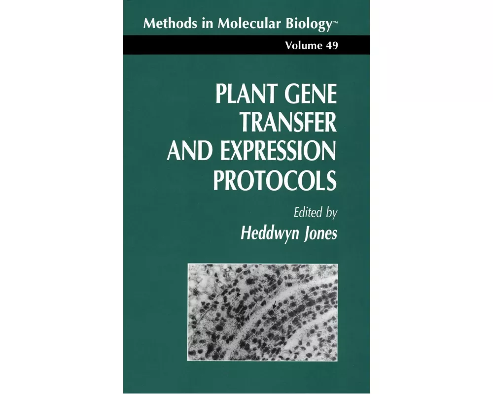 Plant Gene Transfer and Expression Protocols