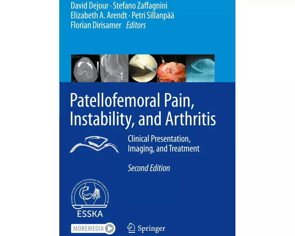 Patellofemoral Pain, Instability, and Arthritis