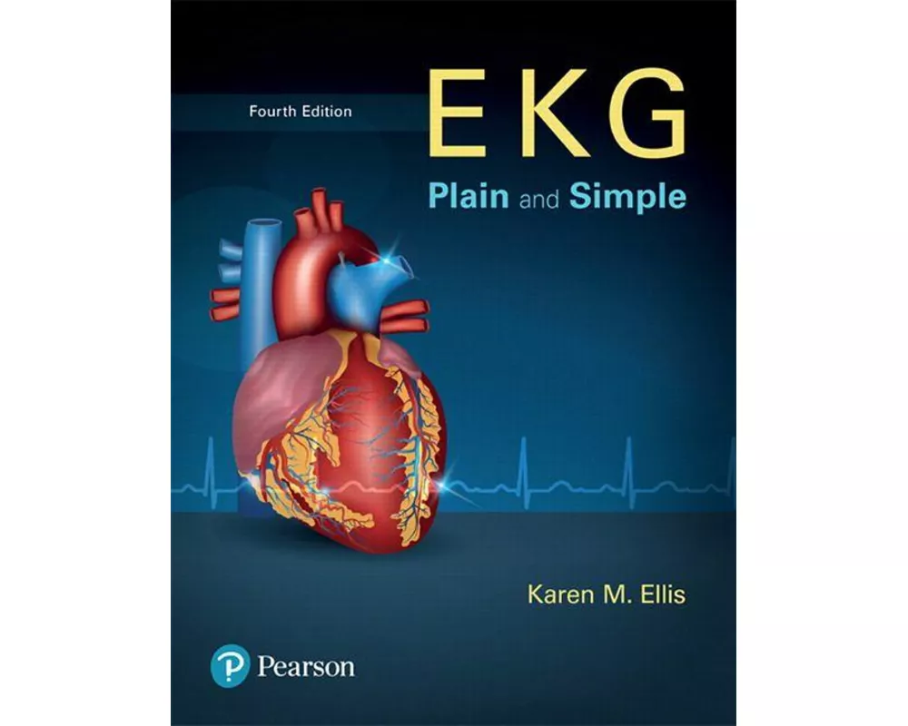 EKG Plain and Simple