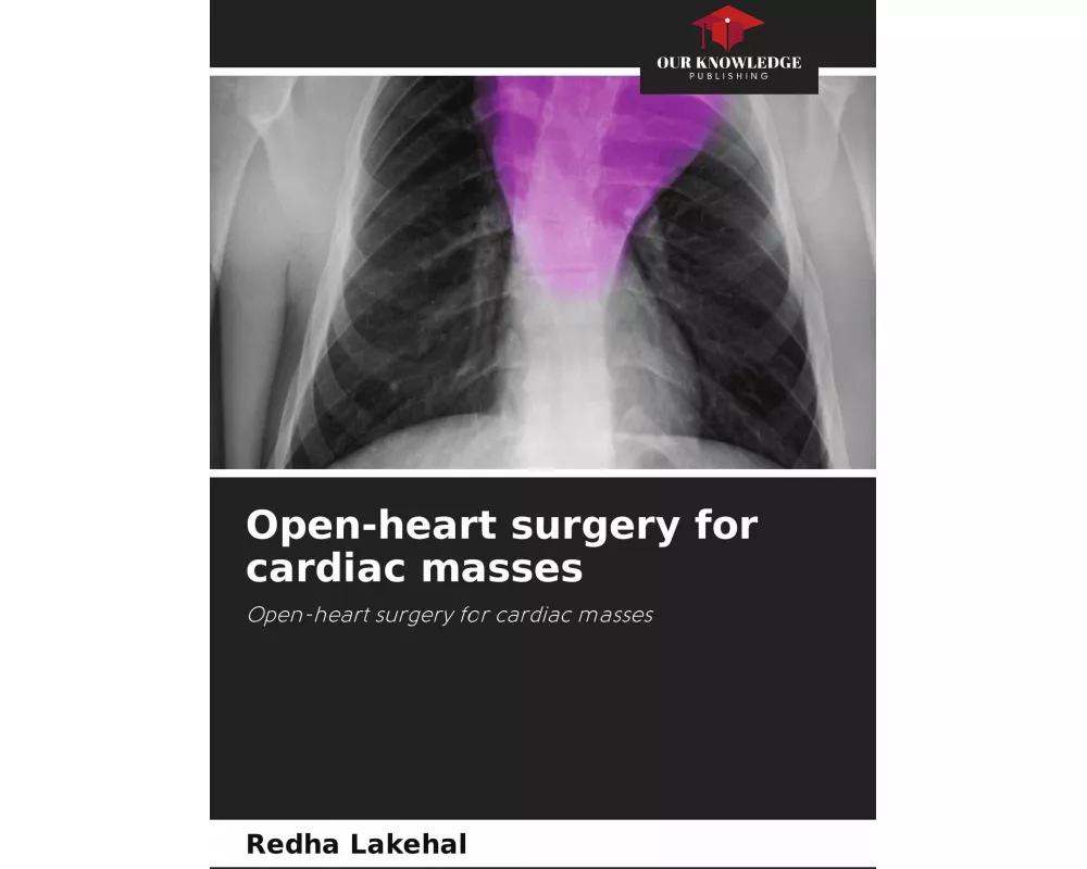 Open-heart surgery for cardiac masses