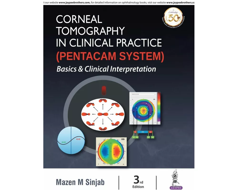 Corneal Tomography in Clinical Practice (Pentacam System)