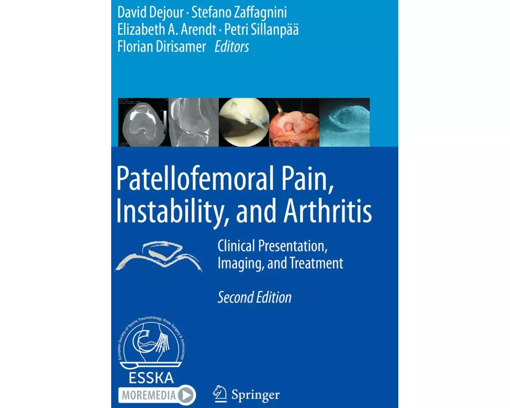 Patellofemoral Pain, Instability, and Arthritis