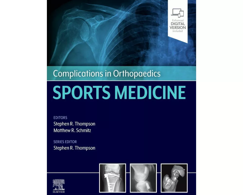 Complications in Orthopaedics: Sports Medicine
