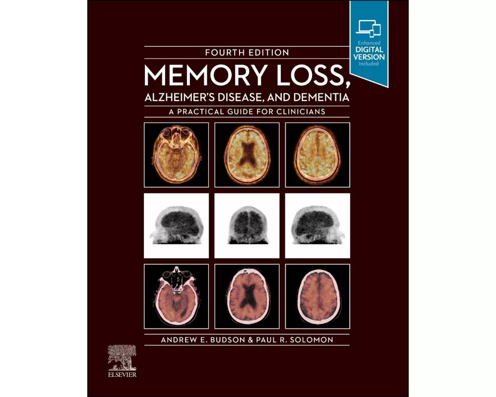 Memory Loss, Alzheimer's Disease and Dementia: A Practical Guide for Clinicians