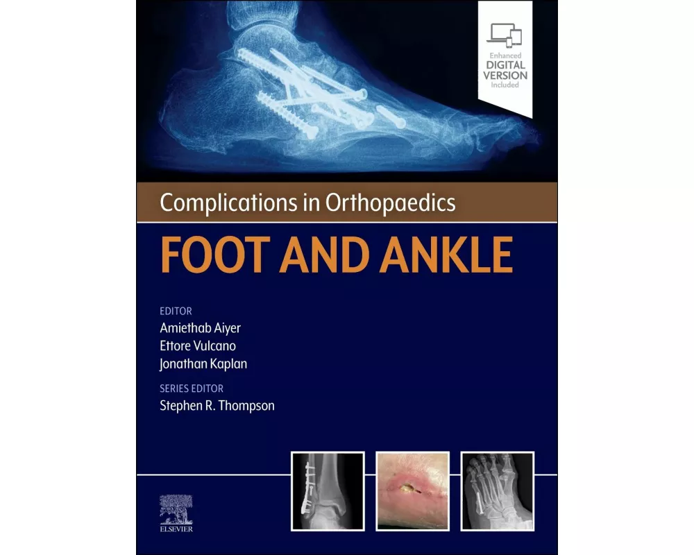 Complications in Orthopaedics: Foot and Ankle