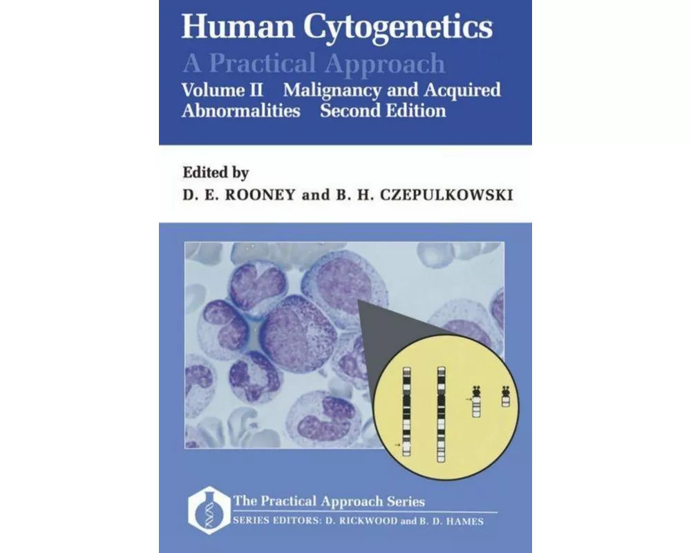 Human Cytogenetics: A Practical Approach: Volume II: Malignancy and Acquired Abnormalities