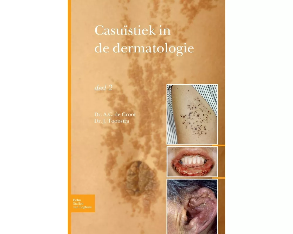 Casuïstiek in de Dermatologie - Deel 2