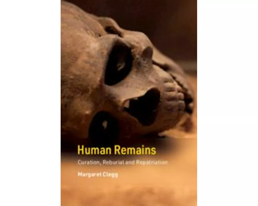 Human Remains
