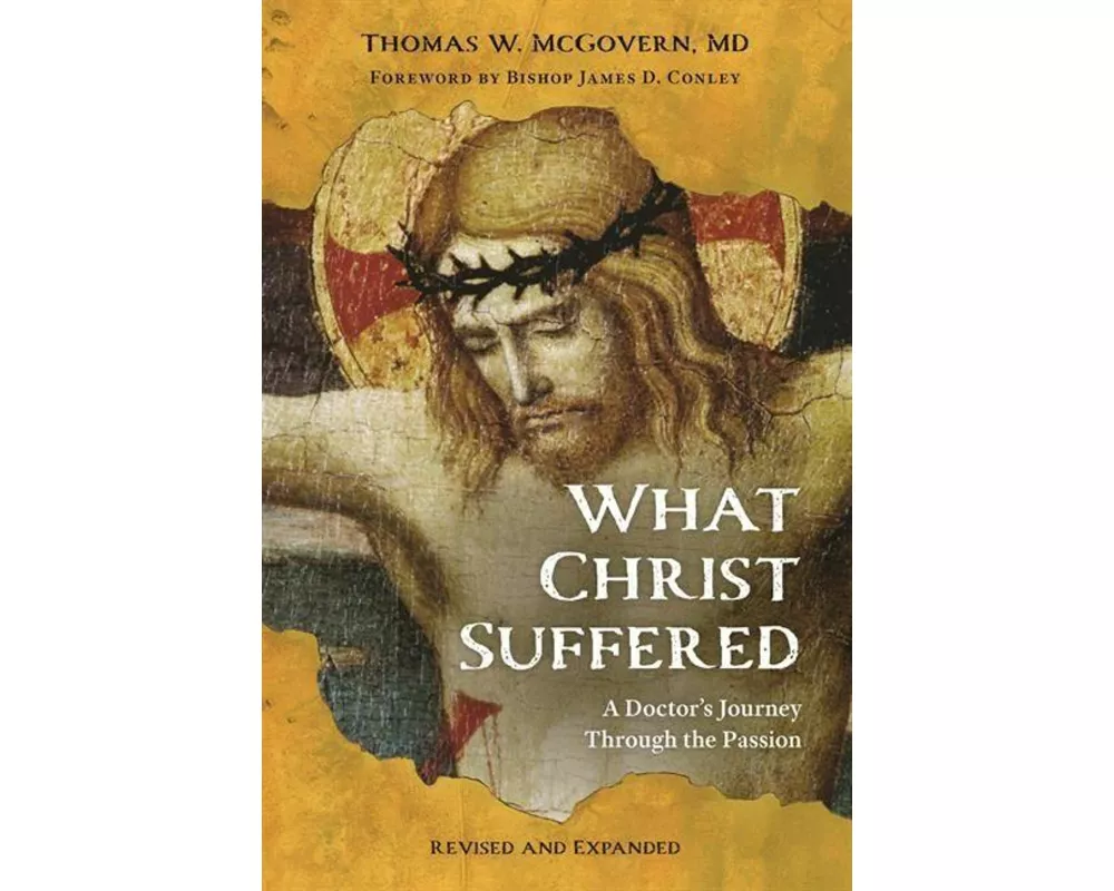 What Christ Suffered