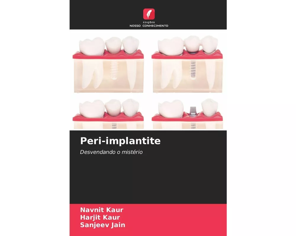 Peri-implantite