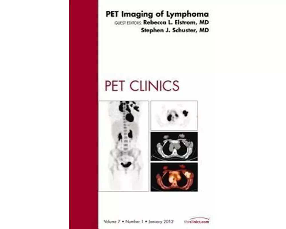 PET Imaging of Lymphoma, An Issue of PET Clinics: Volume 7-1