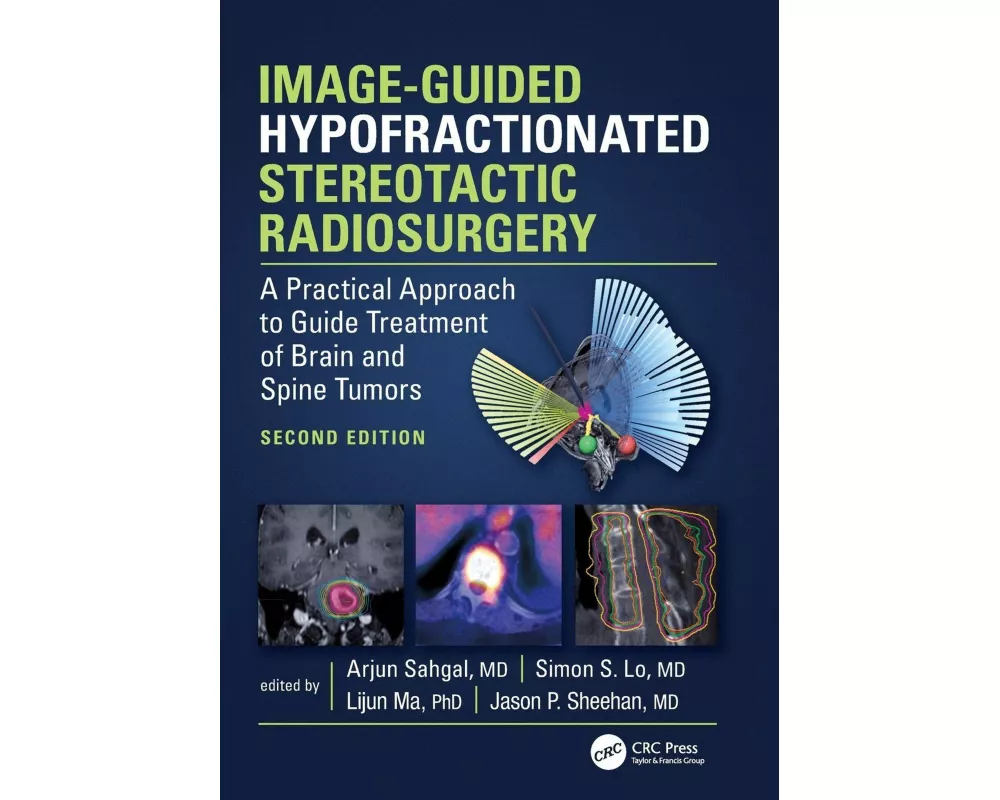 Image-Guided Hypofractionated Stereotactic Radiosurgery