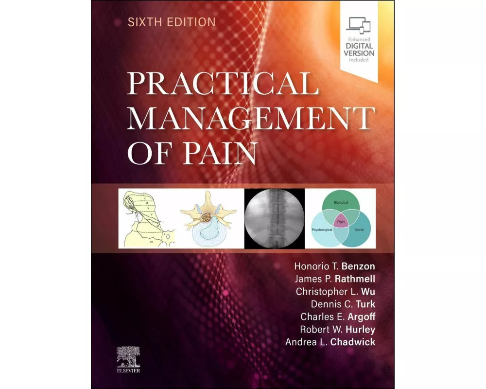 Practical Management of Pain