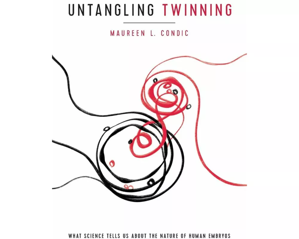 Untangling Twinning
