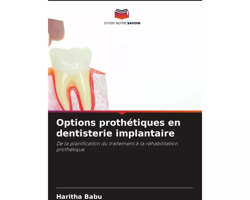 Options prothétiques en dentisterie implantaire