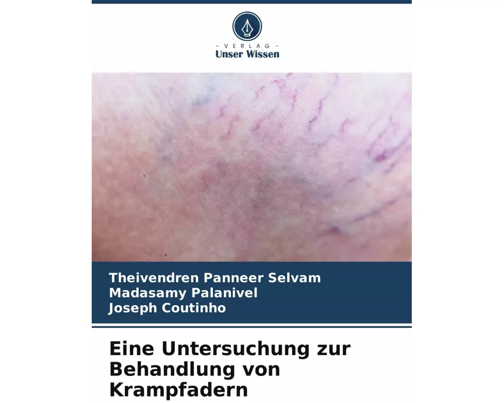 Eine Untersuchung zur Behandlung von Krampfadern