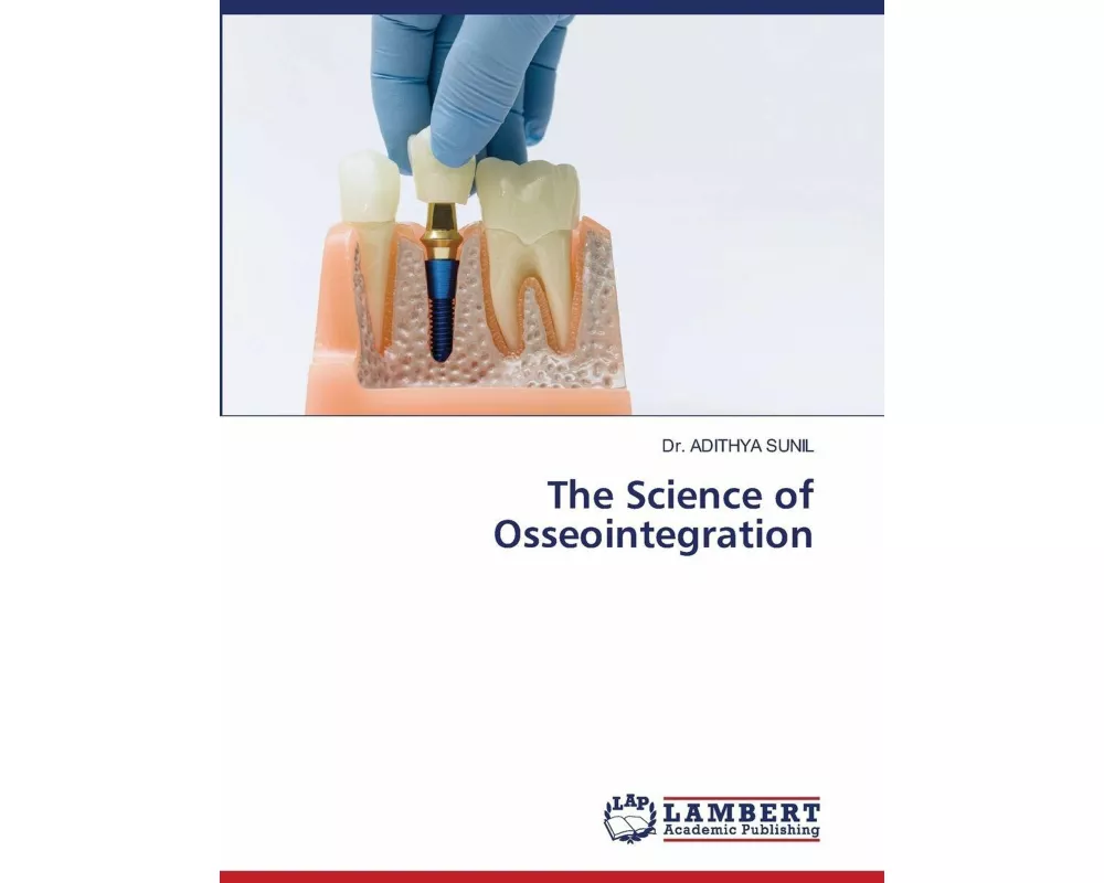 The Science of Osseointegration