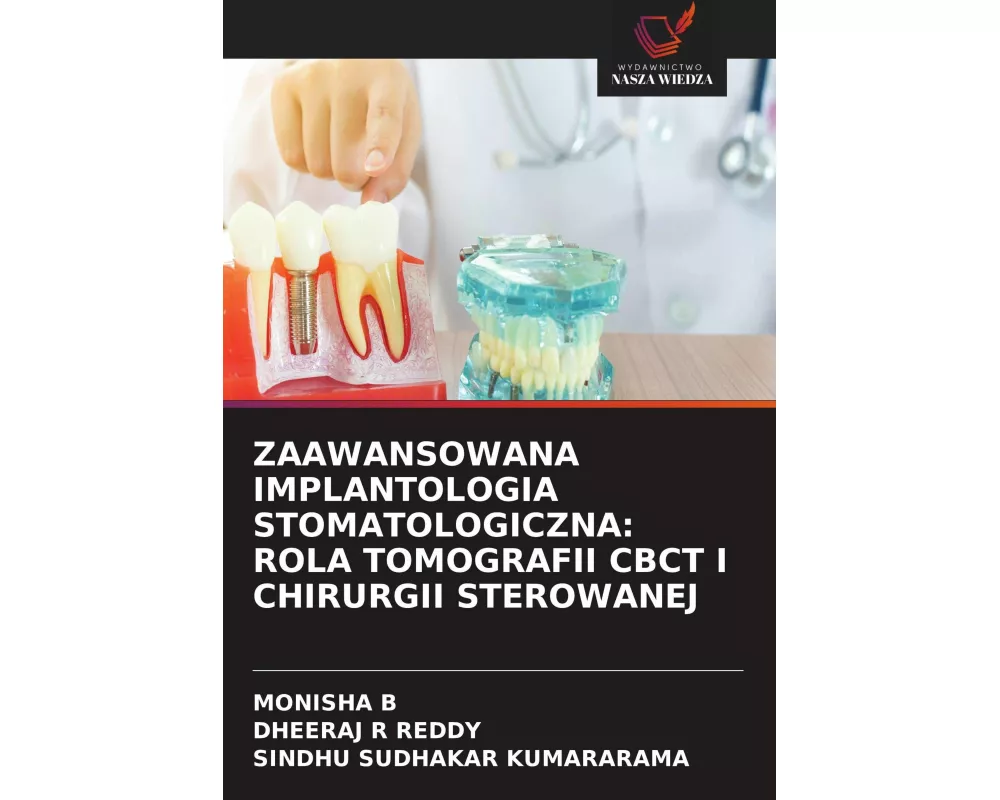 Zaawansowana Implantologia Stomatologiczna: Rola Tomografii Cbct I Chirurgii Sterowanej