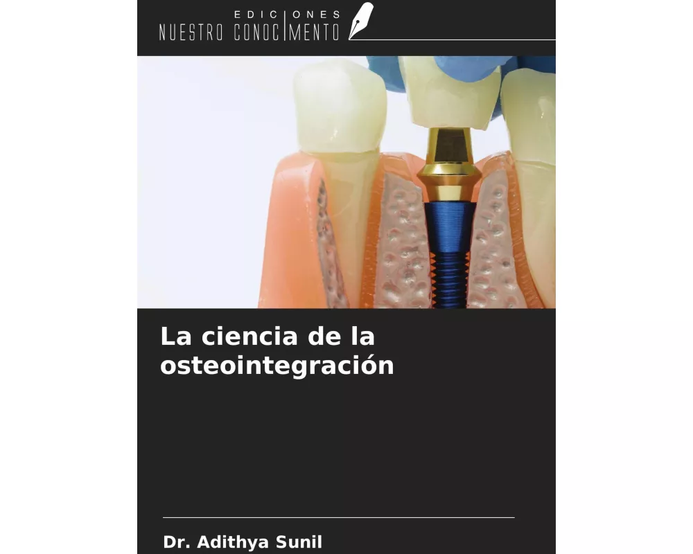 La ciencia de la osteointegración