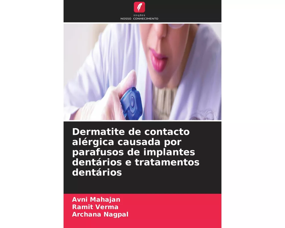 Dermatite de contacto alérgica causada por parafusos de implantes dentários e tratamentos dentários
