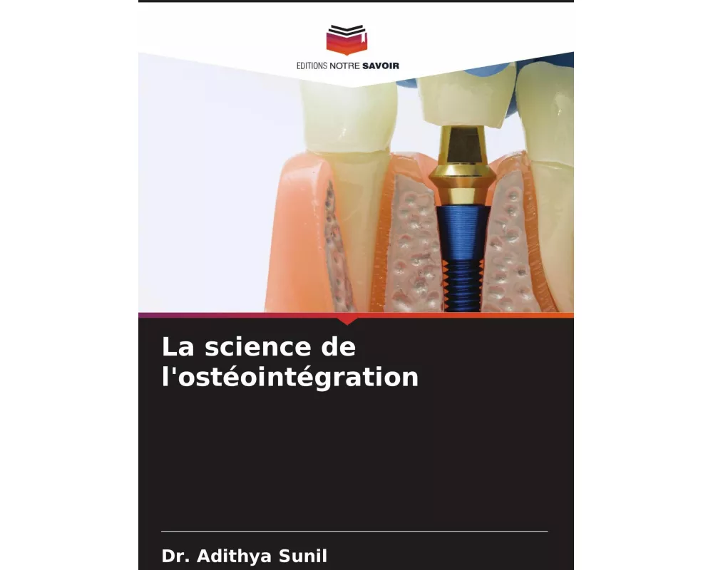 La science de l'ostéointégration