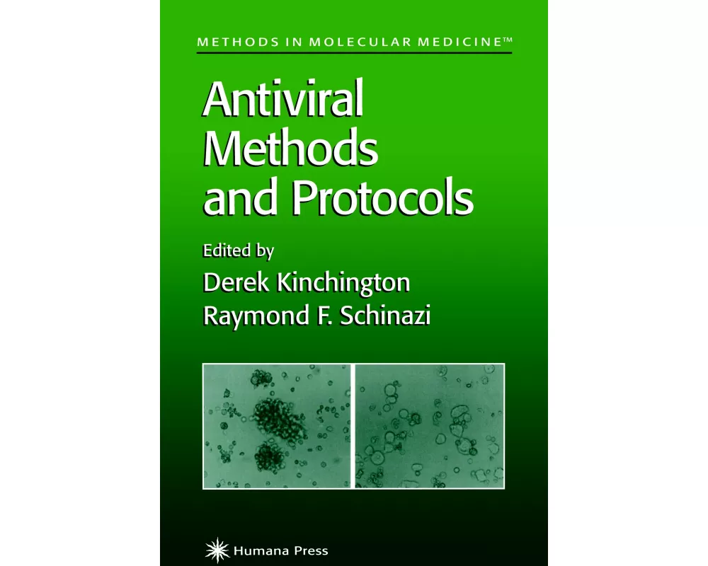 Antiviral Methods and Protocols