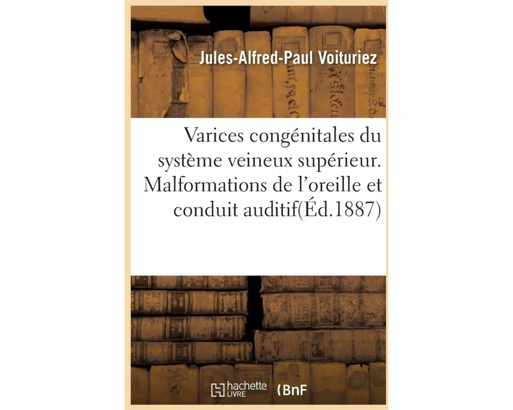 Varices congénitales du système veineux supérieur