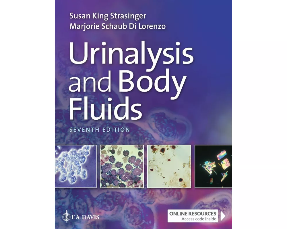 Urinalysis and Body Fluids
