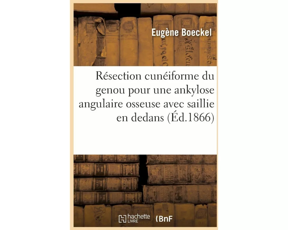 Résection Cunéiforme Du Genou Pour Une Ankylose Angulaire Osseuse Avec Saillie En Dedans