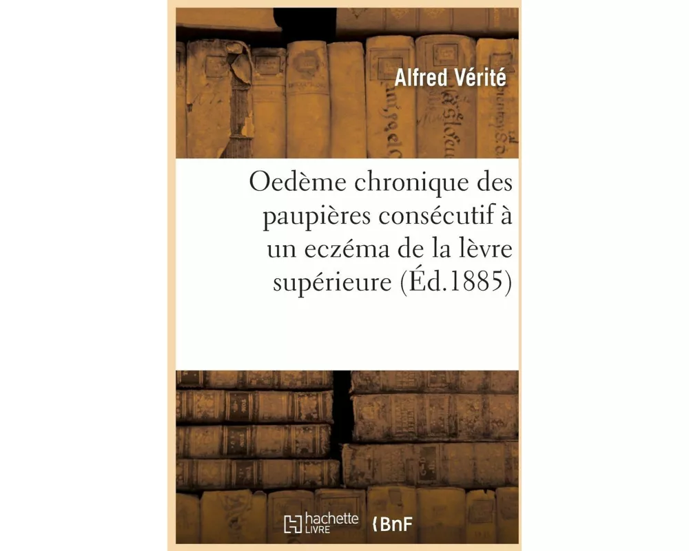 Oedème Chronique Des Paupières Consécutif À Un Eczéma de la Lèvre Supérieure Et Des Fosses Nasales