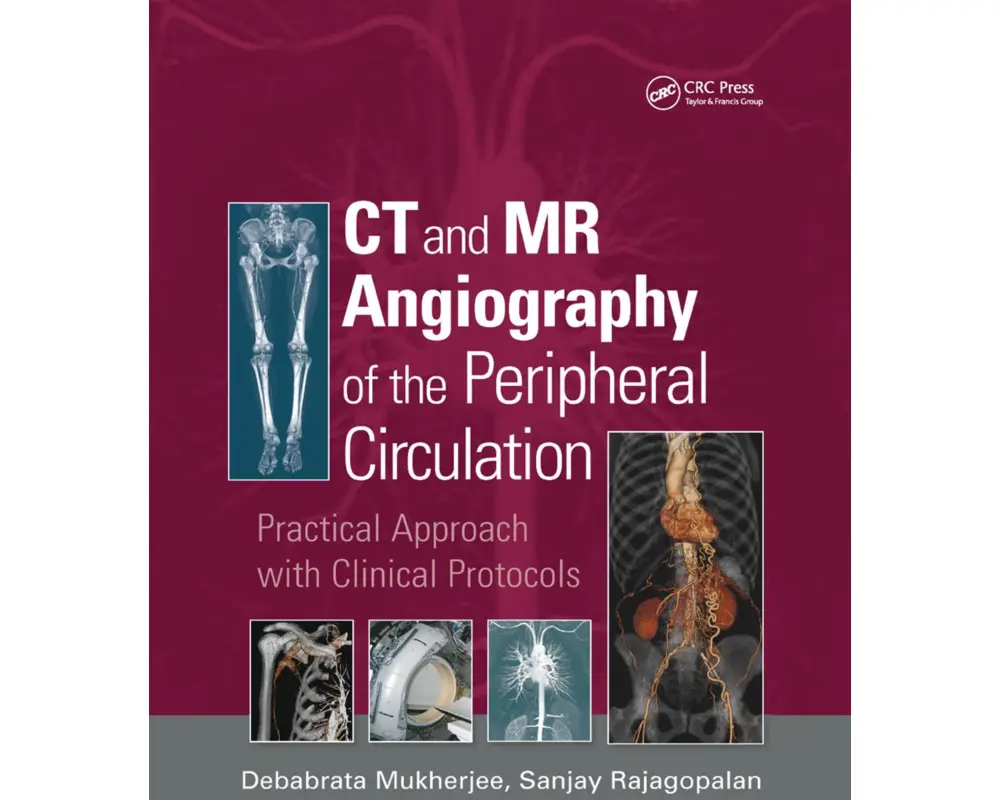 CT and MR Angiography of the Peripheral Circulation