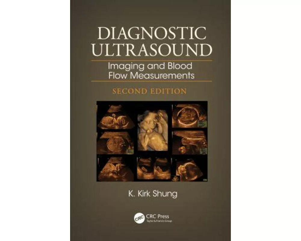 Diagnostic Ultrasound