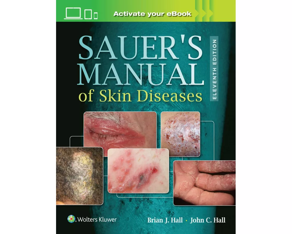 Sauer's Manual of Skin Diseases