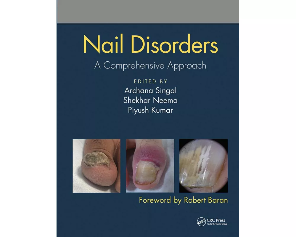 Nail Disorders