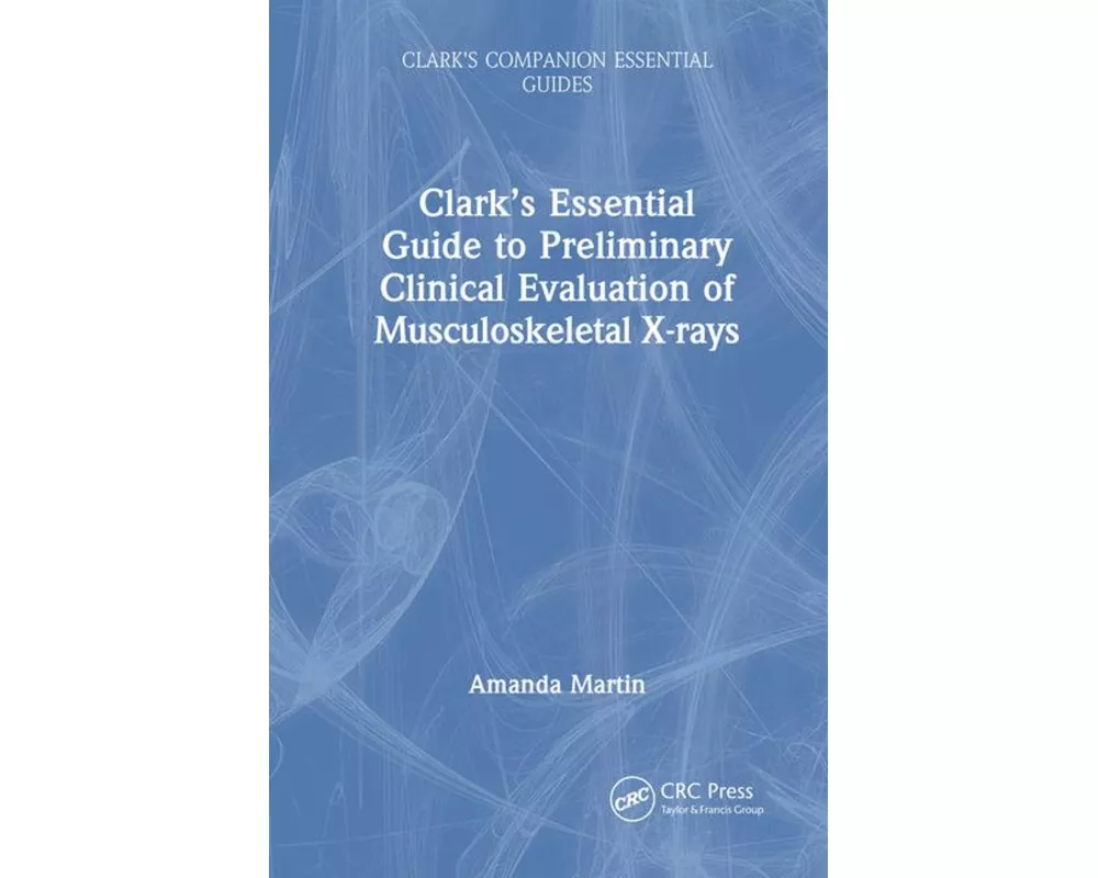 Clark’s Essential Guide to Preliminary Clinical Evaluation of Musculoskeletal X-rays