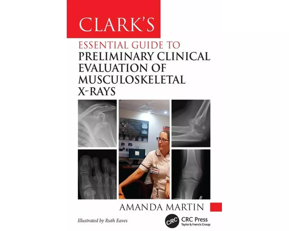 Clark’s Essential Guide to Preliminary Clinical Evaluation of Musculoskeletal X-rays