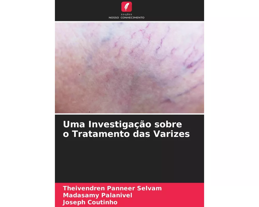 Uma Investigação sobre o Tratamento das Varizes