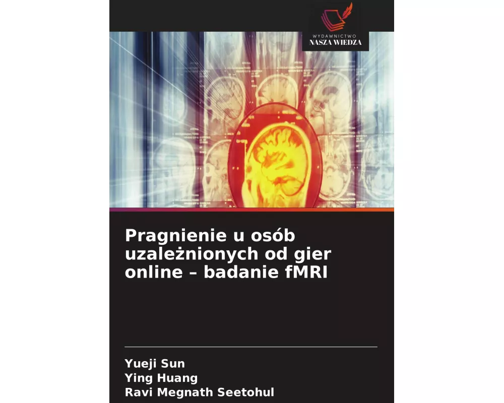 Pragnienie u osób uzale¿nionych od gier online - badanie fMRI