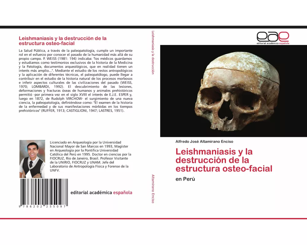 Leishmaniasis y la destrucción de la estructura osteo-facial