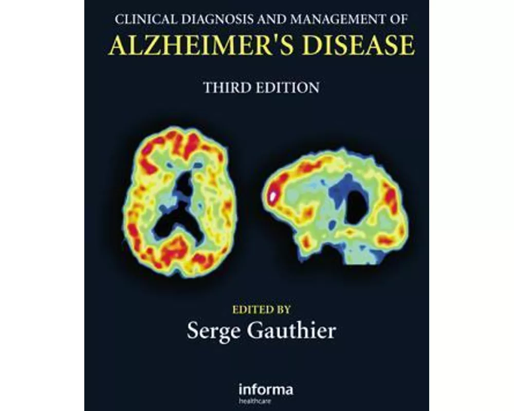 Clinical Diagnosis and Management of Alzheimer's Disease