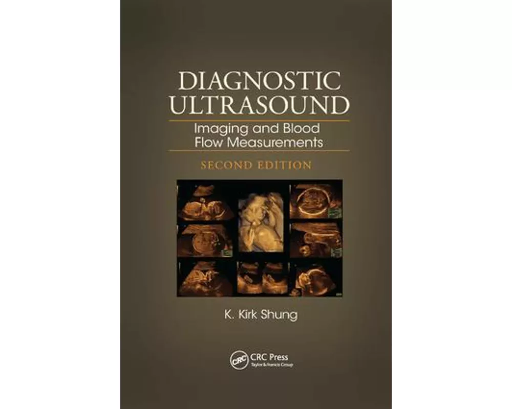 Diagnostic Ultrasound