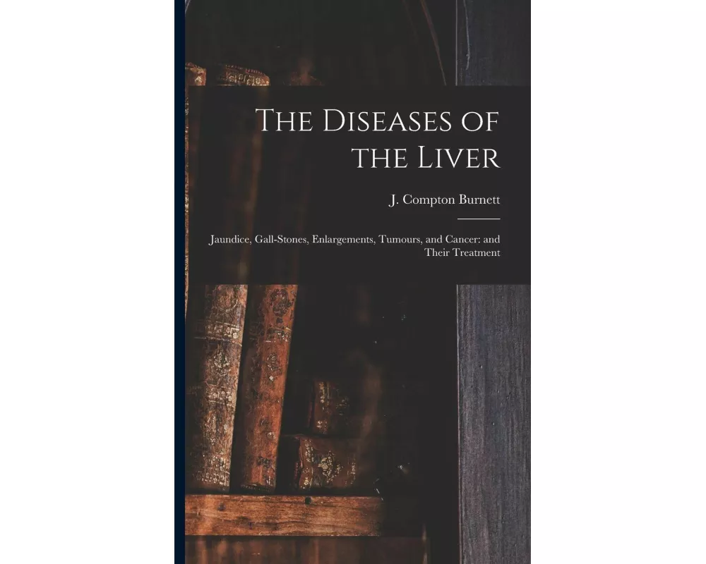 The Diseases of the Liver: Jaundice, Gall-stones, Enlargements, Tumours, and Cancer: and Their Treatment
